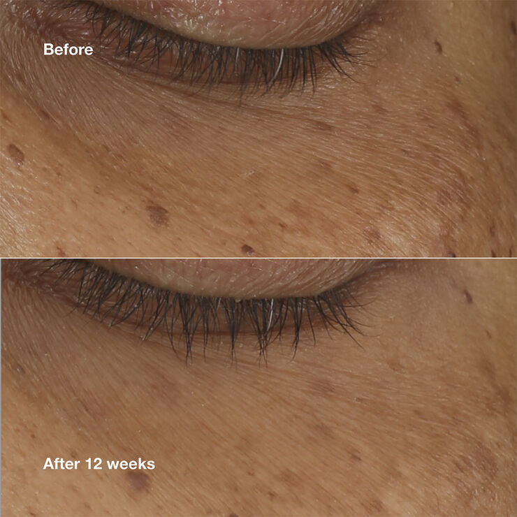 Clinique AAE BRGHTNG SRM CNCNTRAT 10ML/.34FL
