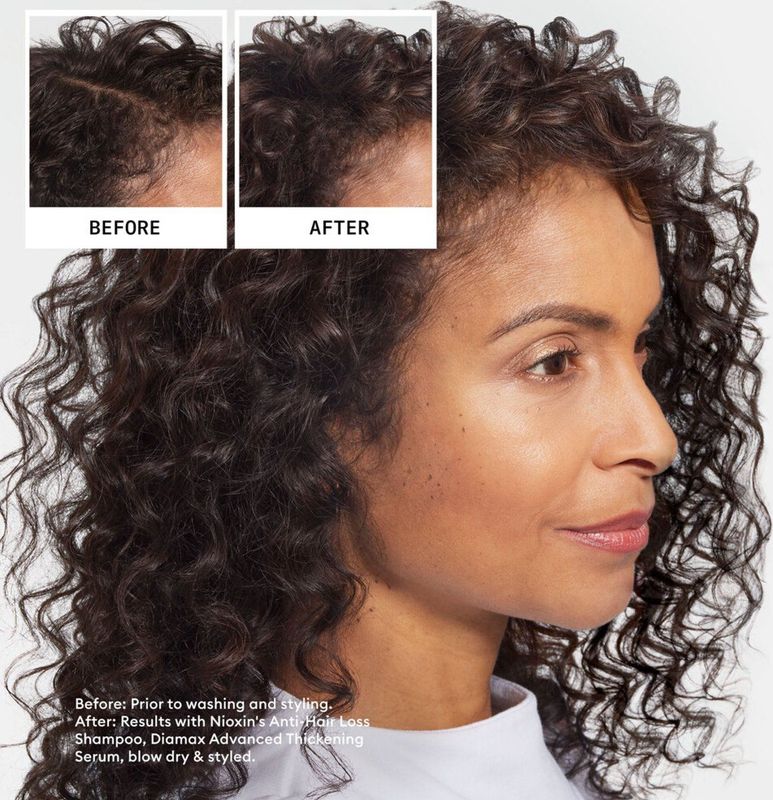 Nioxin Anti Hairloss Shampoo Normale shampoo Voor Alle haartypes