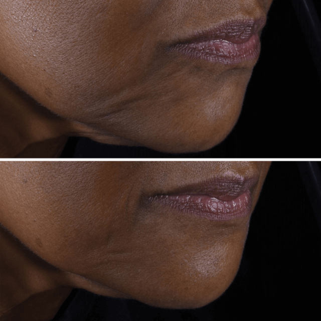 Smart Clinical Repair Crème Liftante Visage et Cou CLINIQUE