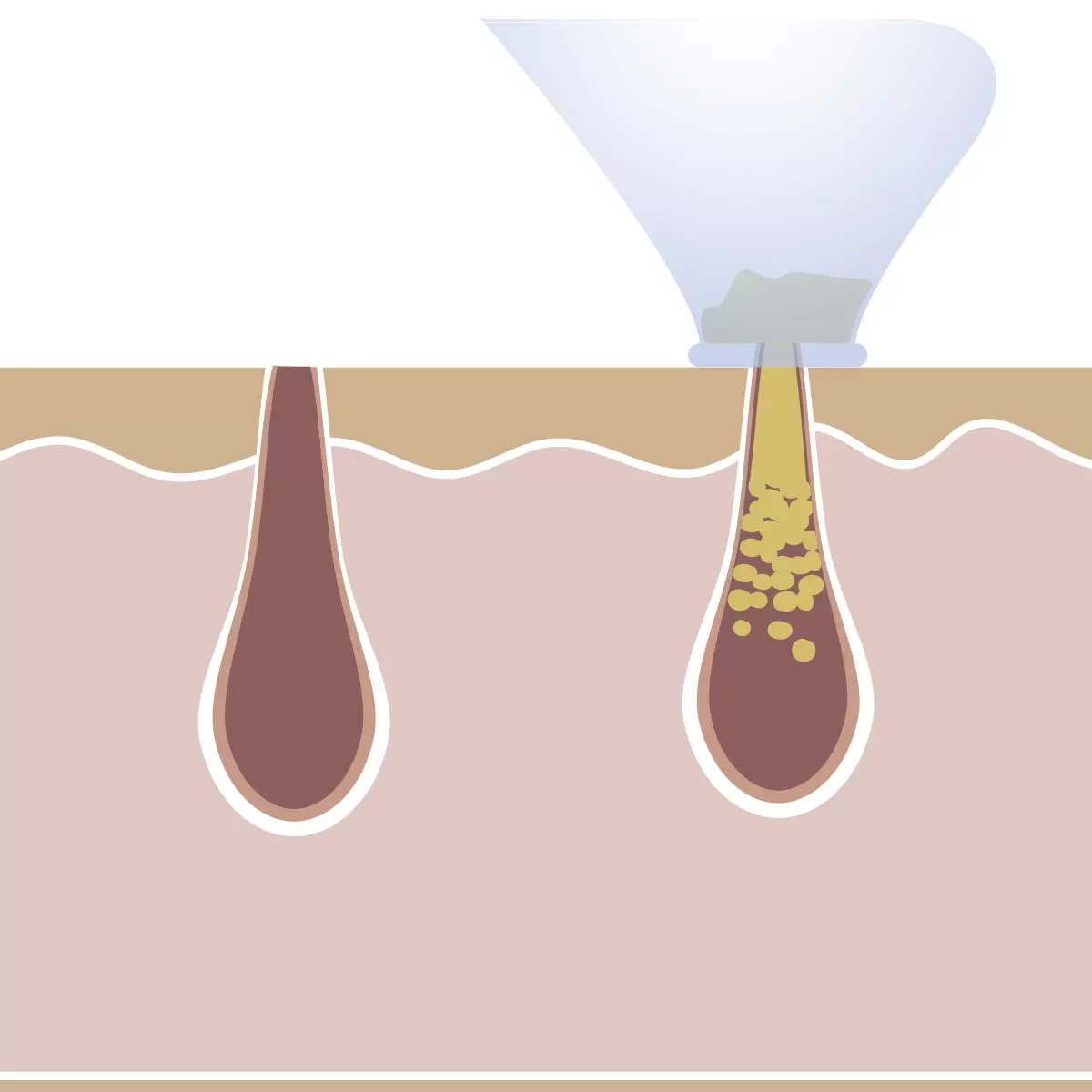Hautreiniger Derma Suction weiss