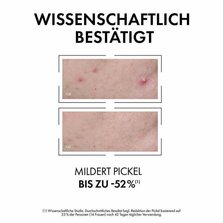 Vichy Normaderm Anti-Unreinheiten Serum, 30 ml