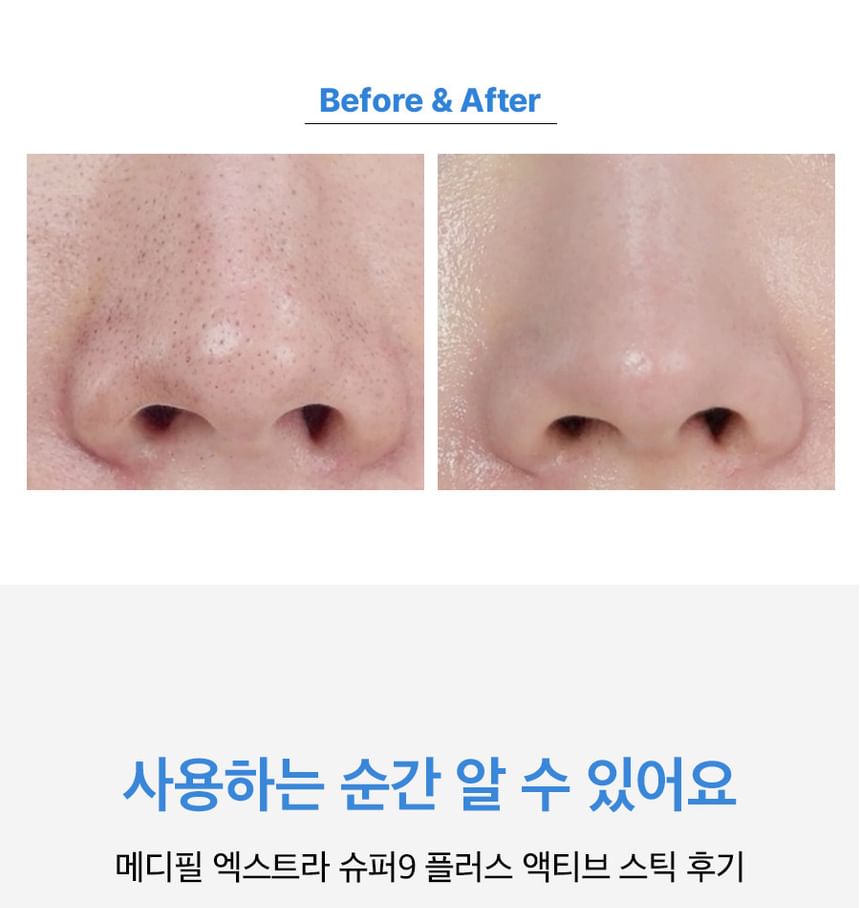 MEDI-PEEL - Extra Super 9 Plus Actieve Stick