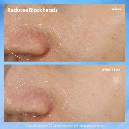 Origins Clear Improvement Blackhead Clearing Mask-To-Scrub, 75 ml