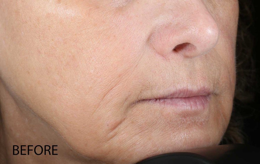 Dermalogica Biolumin-C Serum 59ml