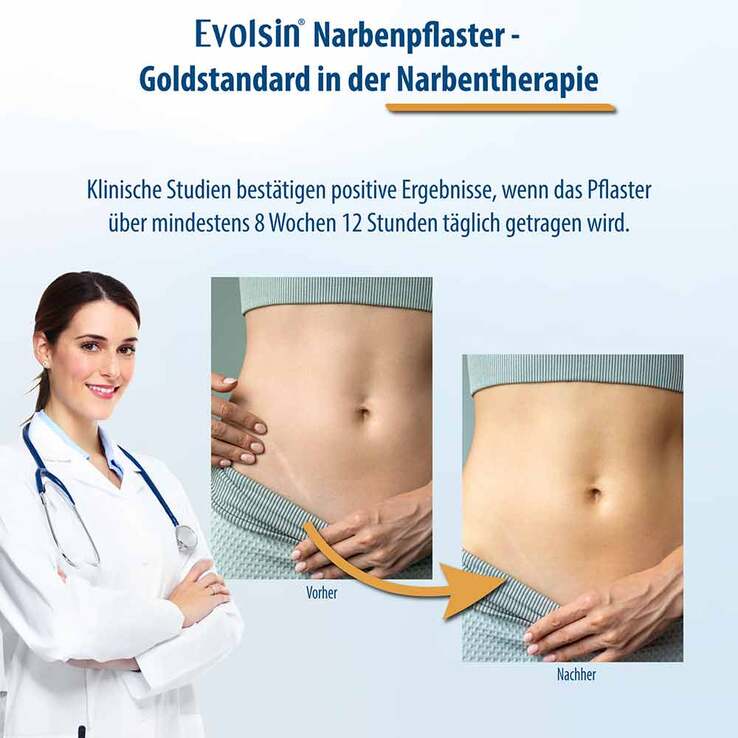 Evolsin Narbenpflaster 2,5cm x 200cm, 1 St