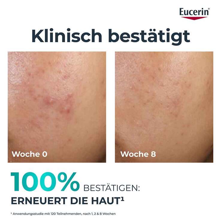 Eucerin Dermopure Clinical Peeling 10 Nachtcreme, 40 ml