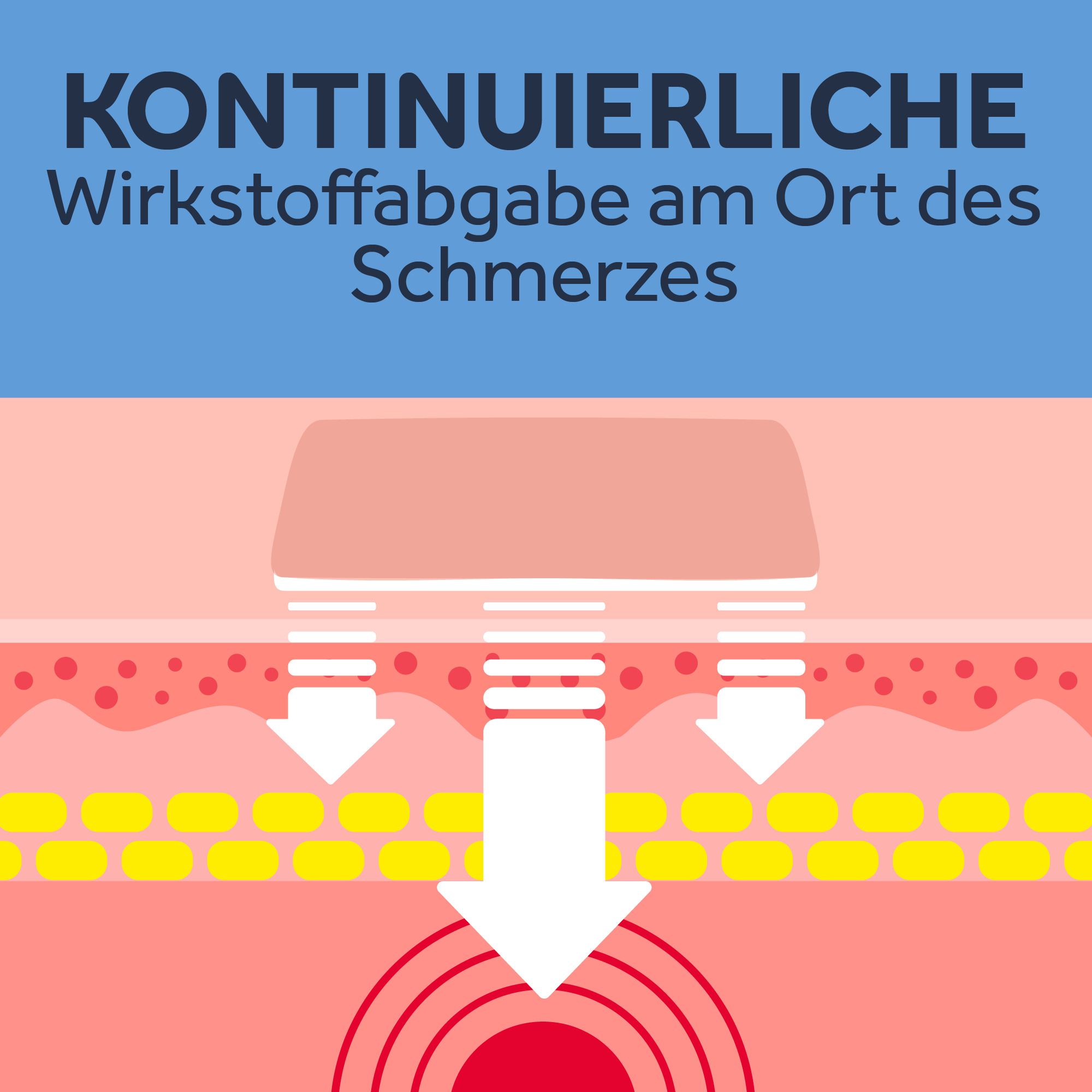 NUROFEN® 24-Stunden Schmerzpflaster