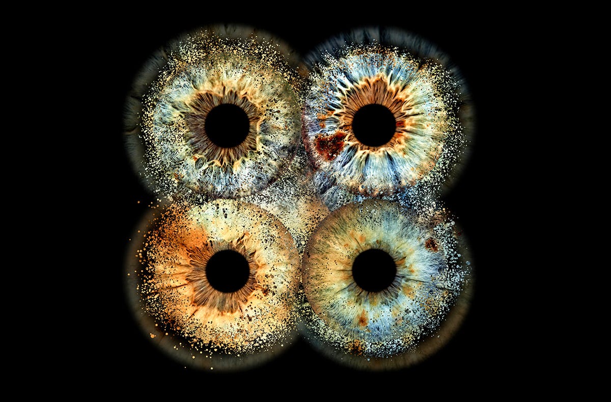 Irisfotografie Familie Haßfurt