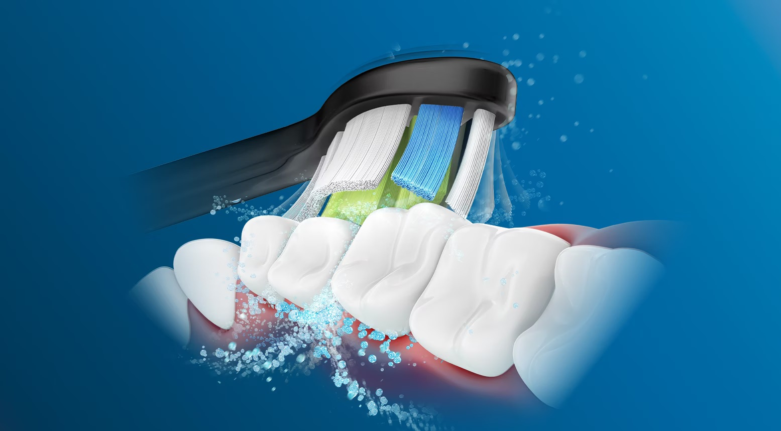 (4er Set) W2 Optimal White Ersatz Zahnbürstenkopf für Philips Sonicare Elektrische Zahnbürsten (HX6064/11) - Schwarz