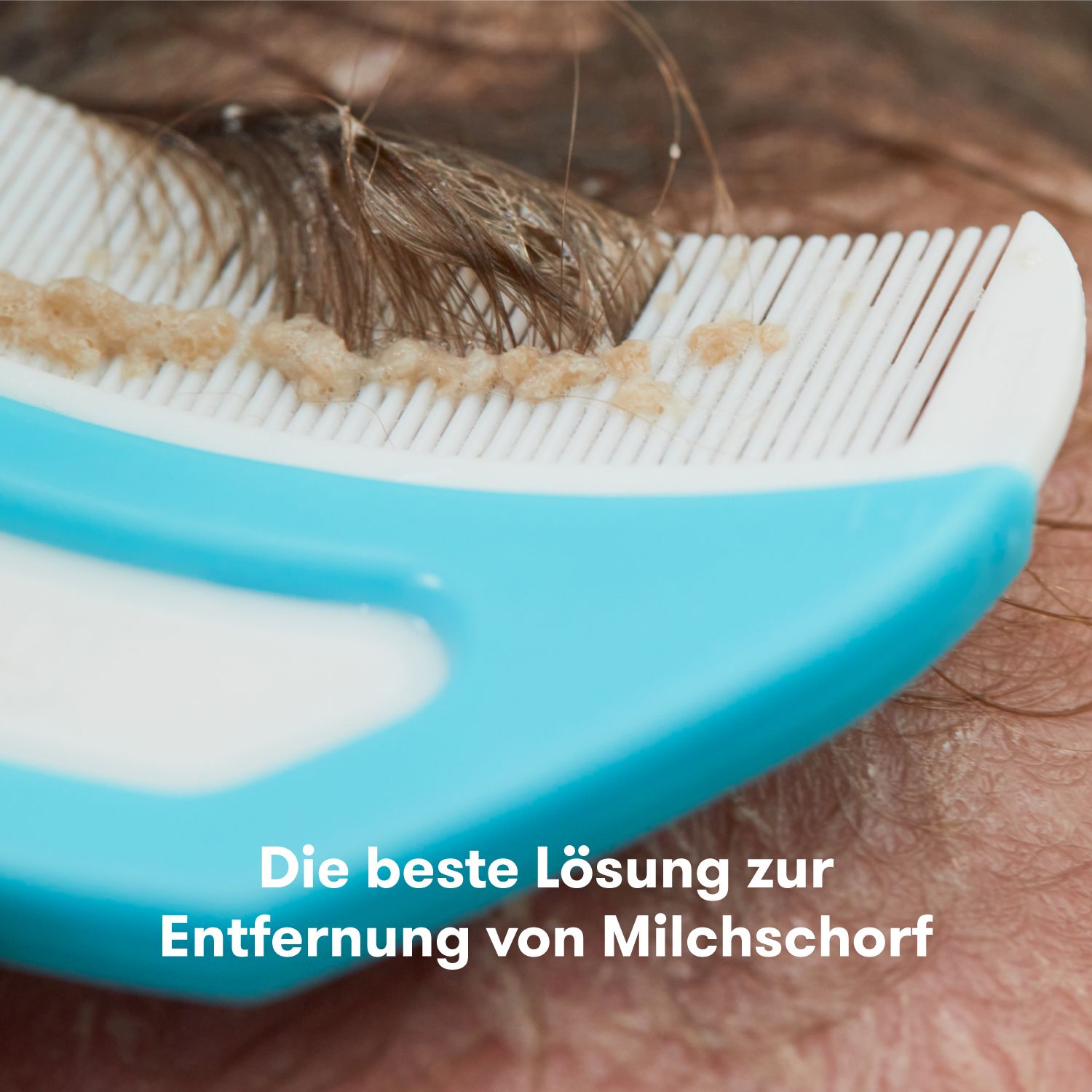 Frida Baby Flake Fixer 3-in-1 Milchschorf-Set