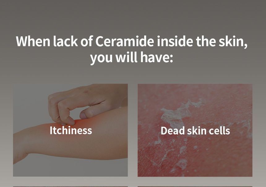 Benton - Ceramide Crème 10000ppm