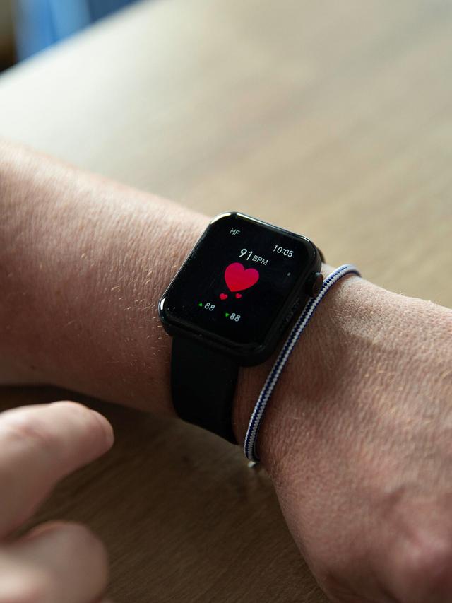 Smartwatch 