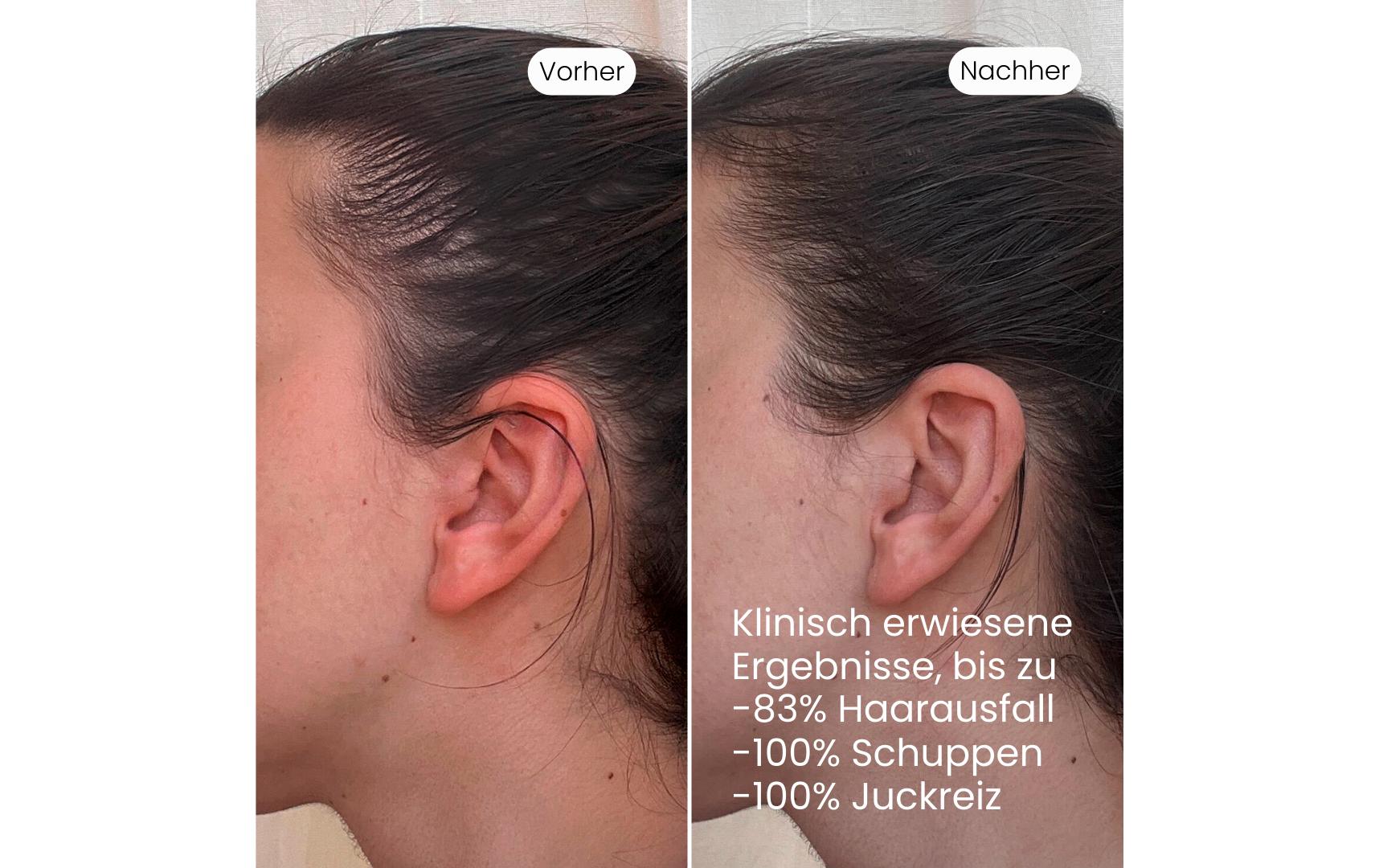 Tages-Kopfhaut-Elixier +UV 100 mlNatürliches Haarwasser gegen Haarausfall