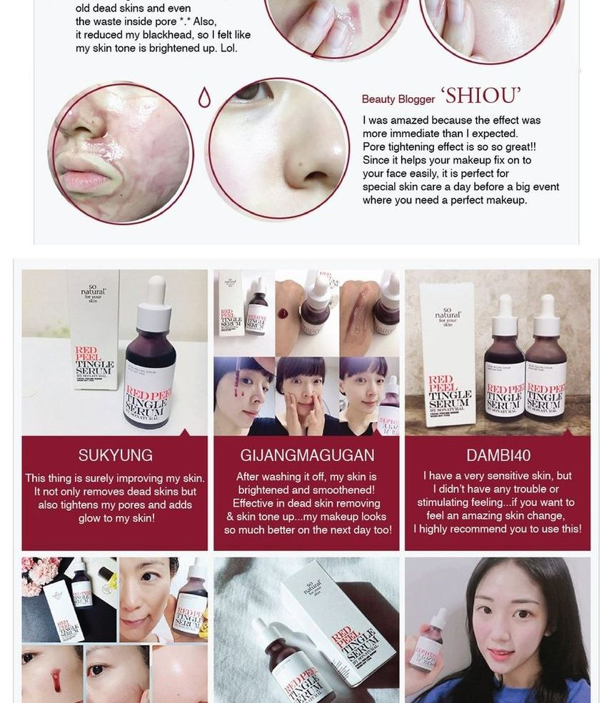 zo natuurlijk - Red Peel Tingle Serum