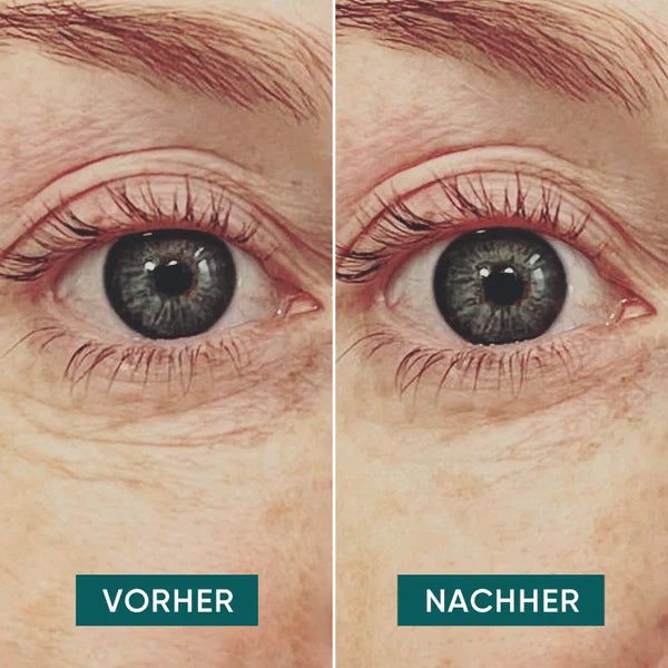 APRICOT Augen Pads  