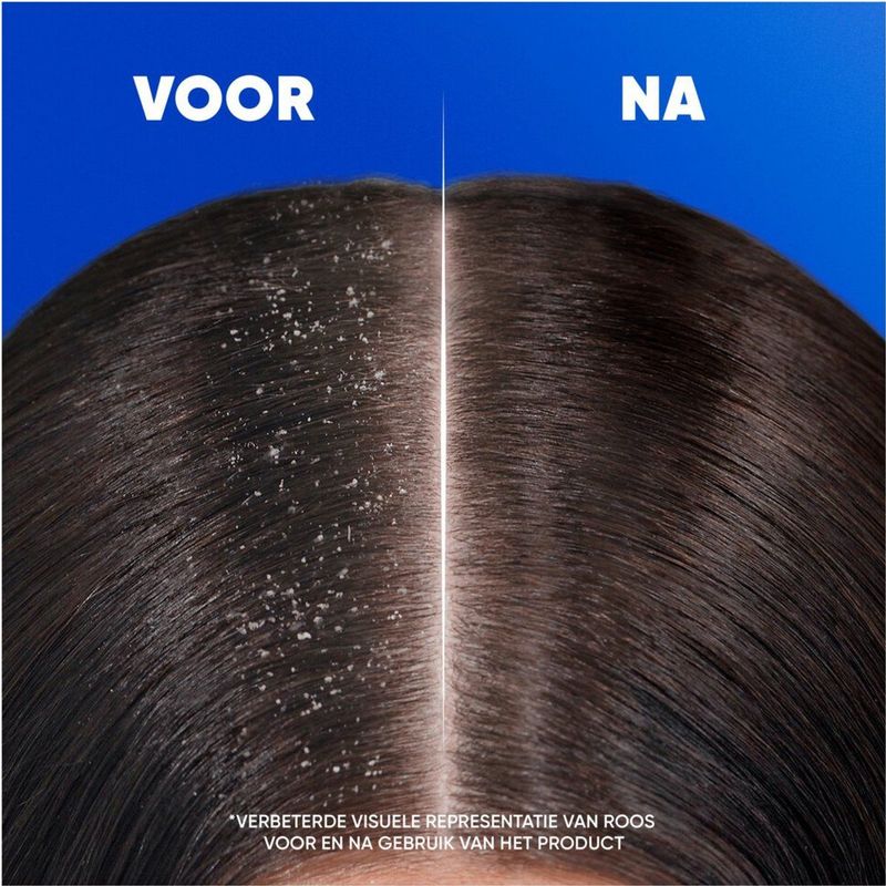 Head & Shoulders Shampoo Jeukende Hoofdhuid