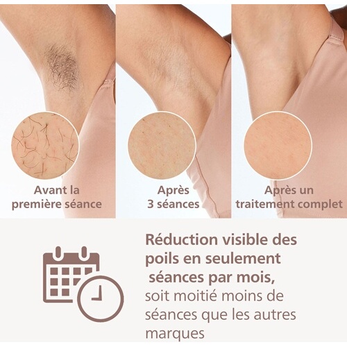 Epilation semi-définitive Philips Lumea BRI949/00 Epilateur à lumière pulsée