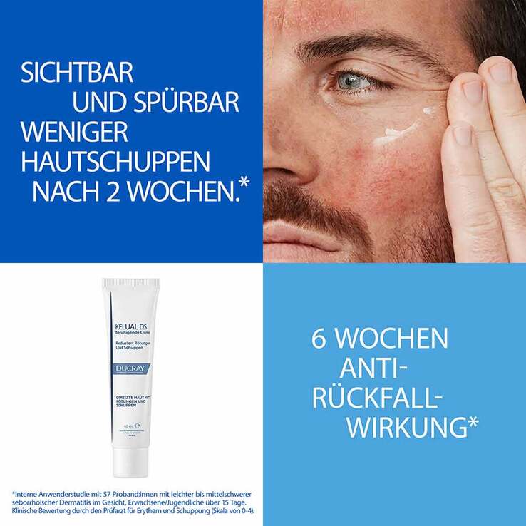Ducray Kelual DS Creme beruhigend, 40 ml