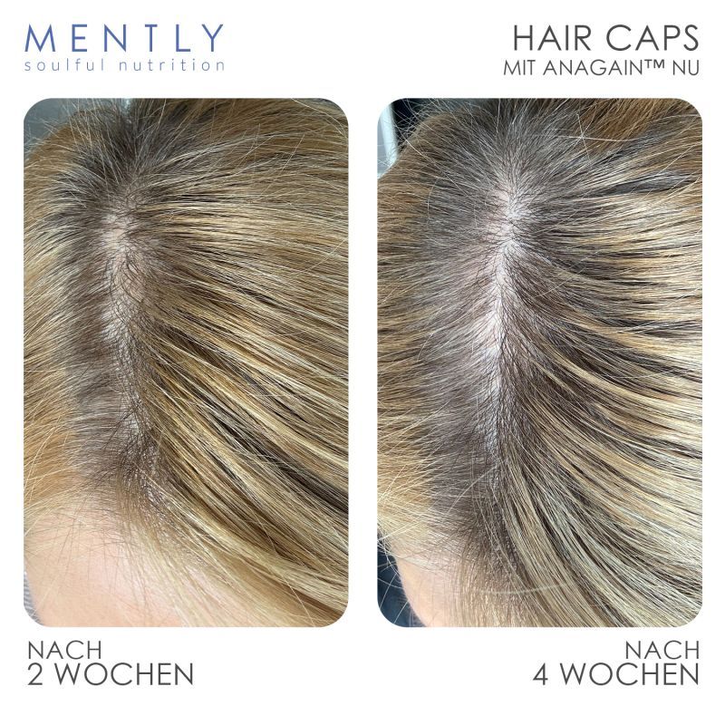 MENTLY Hair Caps