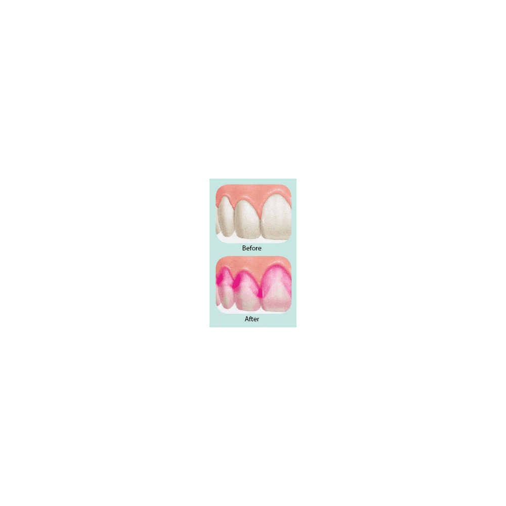 Gum Red-Cote farvetabletter - 12 stk.
