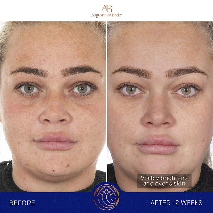 Augustinus Bader The Face Cream Mask