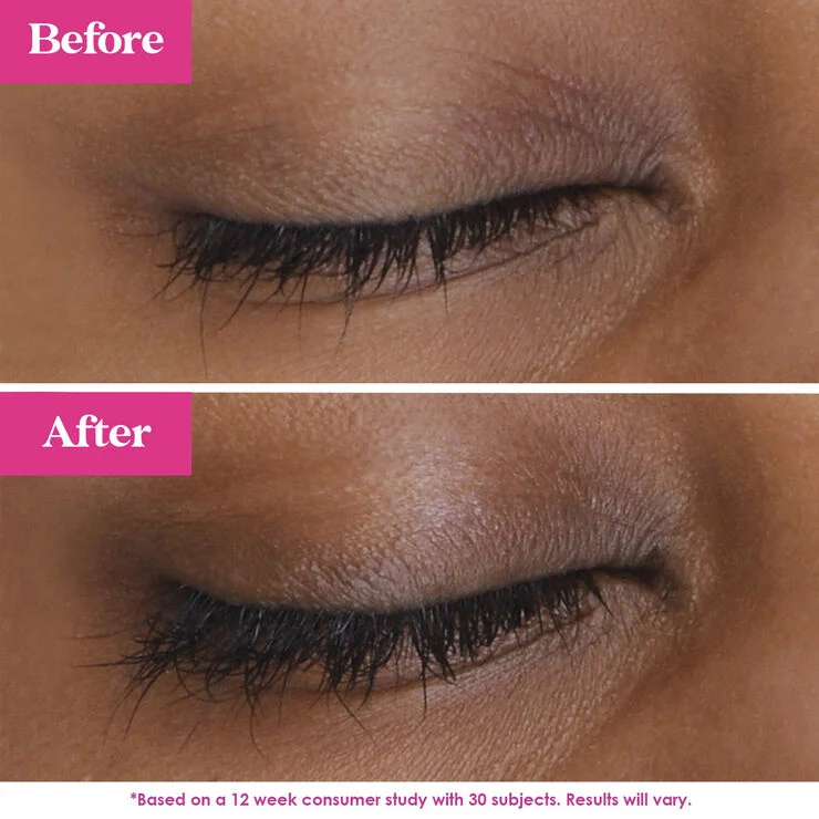 Grande Cosmetic GRANDE LASH MD 2ML