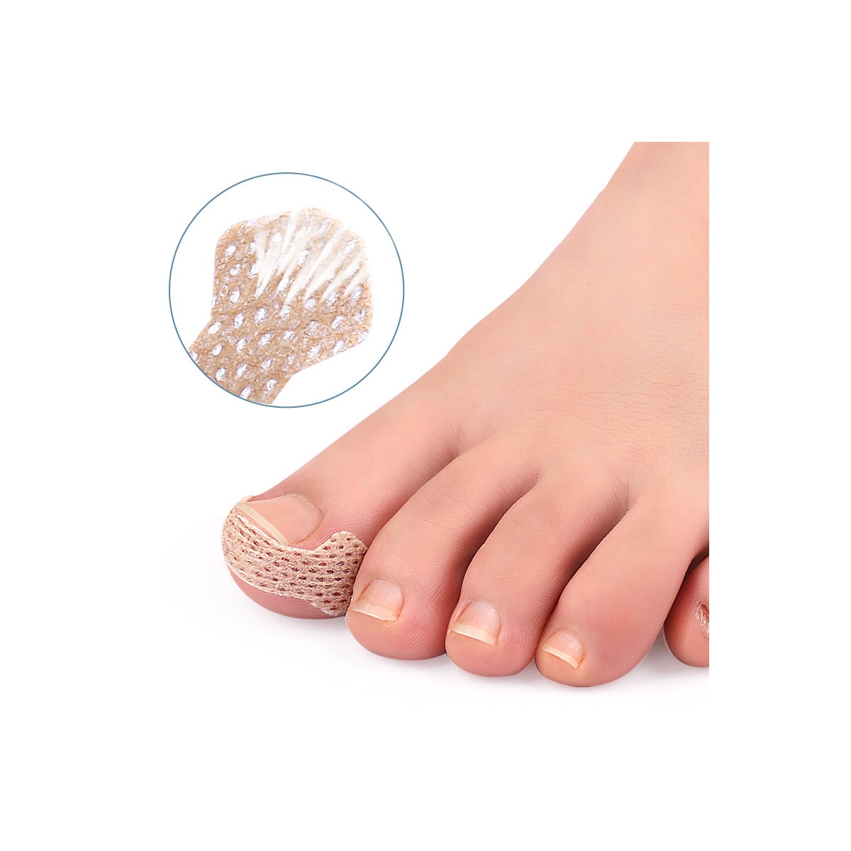 Gips for inngrodde tånegler Beige