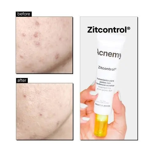 Zitcontrol Treatment Cream