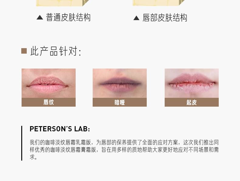 PETERSON'S LAB - Anti-rimpel lipcrème - 2 soorten