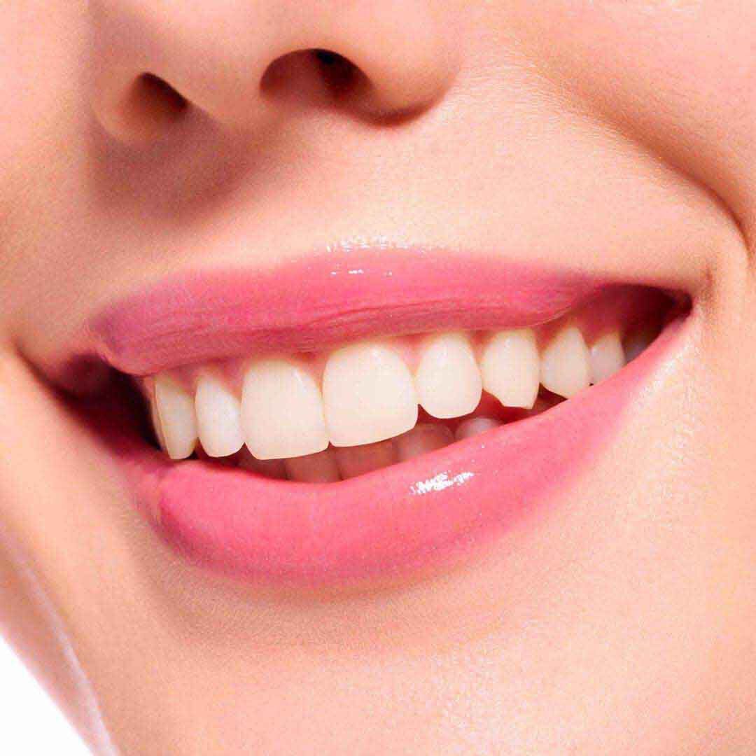 Lipgloss Extreme Shine Volume