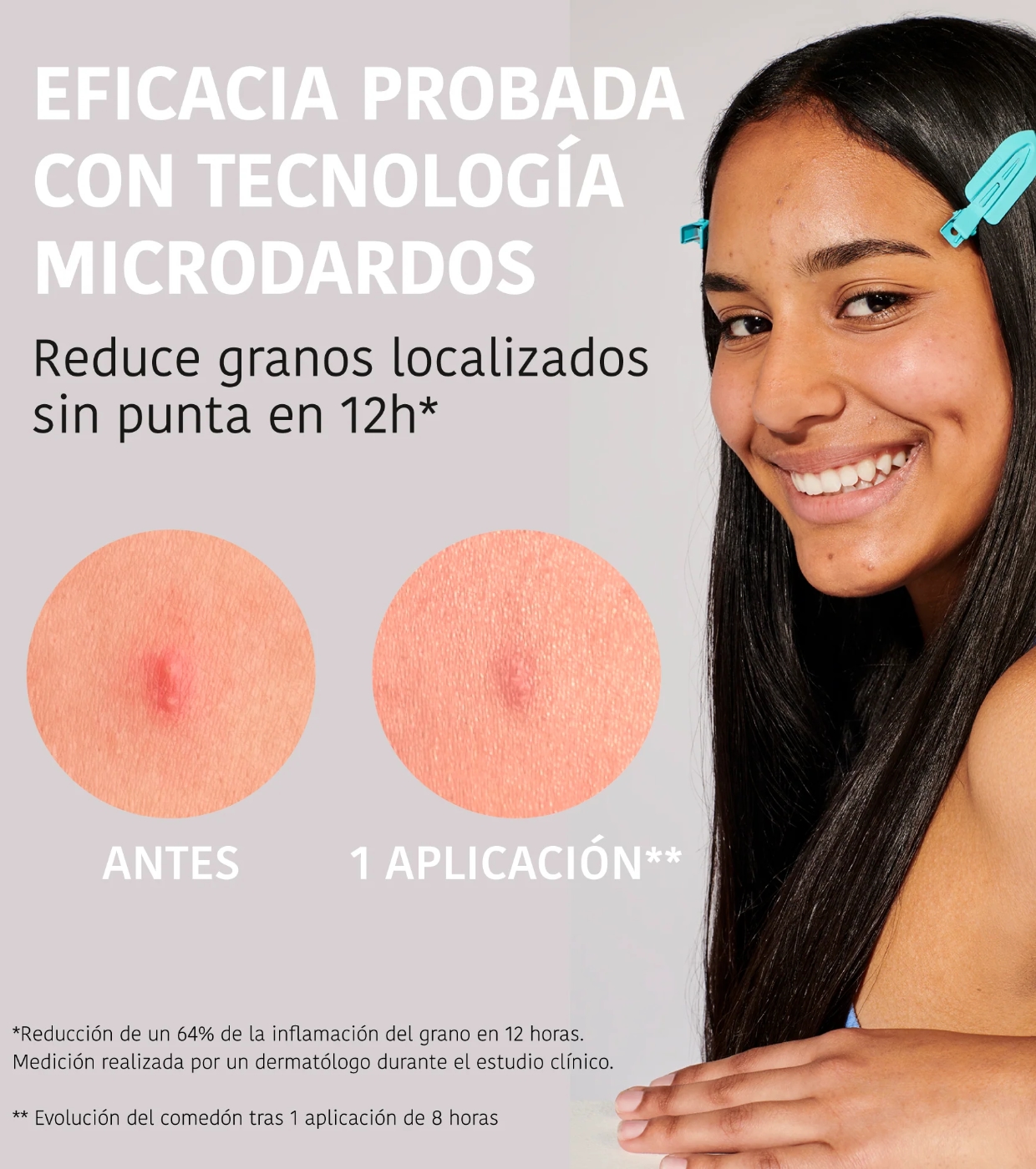 Iroha Nature - *Acne Prone Skin* - Adesivos de ácido salicílico para espinhas Microdarts