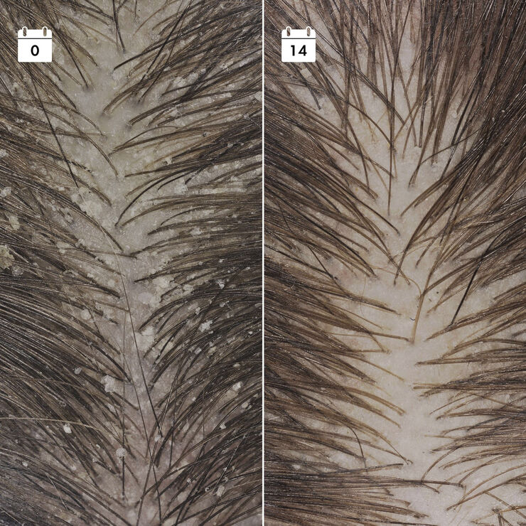 Sephora Collection Serum mod tilbagevendende skæl - Serum til hovedbunden