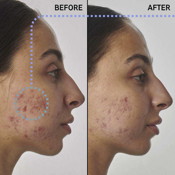 THE INKEY LIST Scar, mark and wrinkle solution with 1% retinol - Face serum