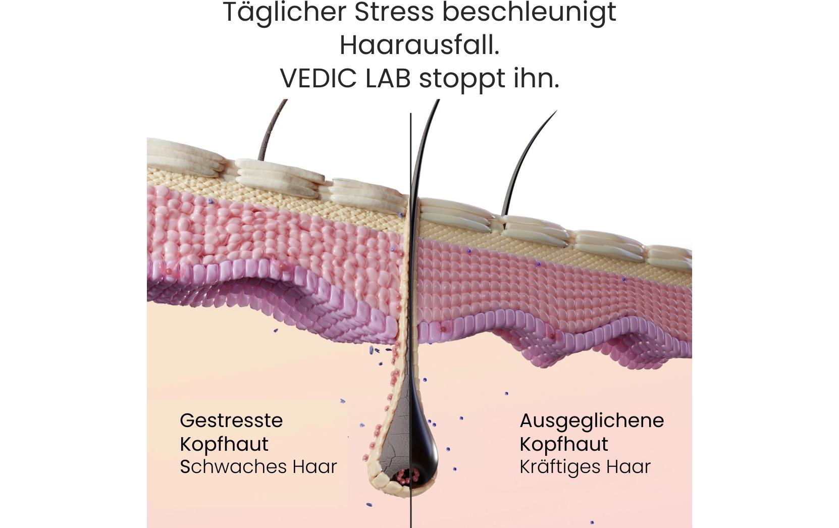 Tages-Kopfhaut-Elixier +UV 100 mlNatürliches Haarwasser gegen Haarausfall