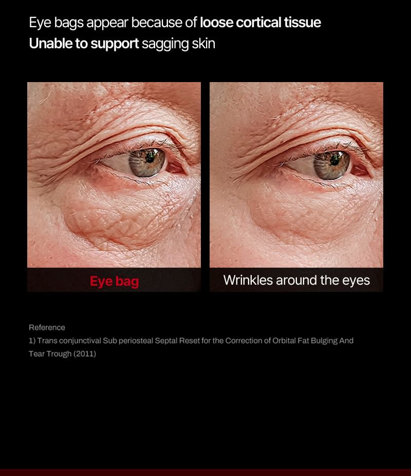 Meditherapie - Wrinkle-Fit Tangle Eye Cream