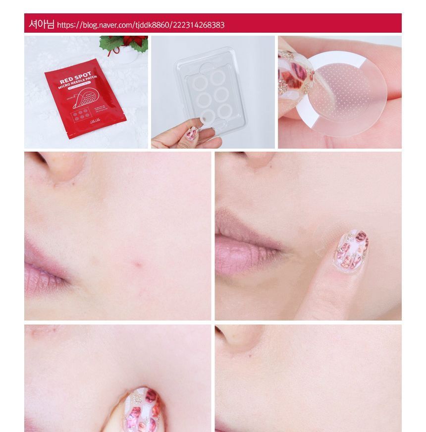 RiRe - Rode Vlek Micronaaldpleister