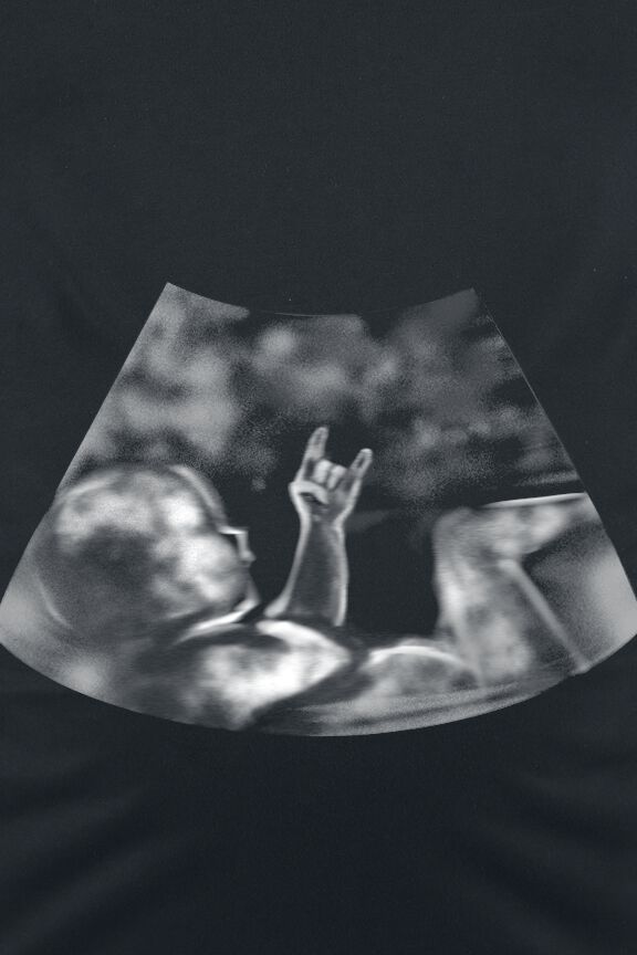 Ultrasound Metal Baby Hand | Vêtements de maternité T-shirt manches longues