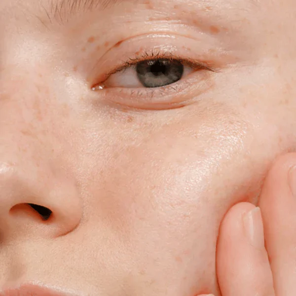 Mádara Sérum Botanique Alternatif Niacinamide 5 en 1 - Full size 30ml