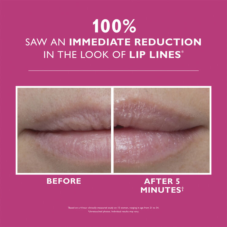 Peter Thomas Roth Peter Thomas Roth Instant FIRMx® Lip Filler 10 ml