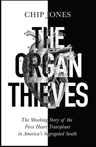 The Organ Thieves: The Shocking Story of the First Heart Transplant in America's Segregated South (Paperback)