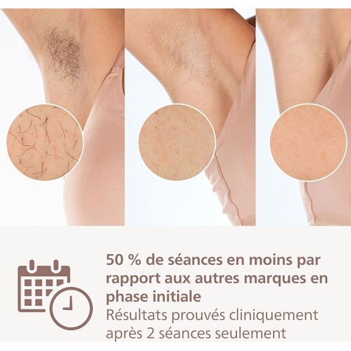 Epilation semi-définitive Philips Lumea série 9900, BRI950/02Epilateur à lumière pulsée sans-fil