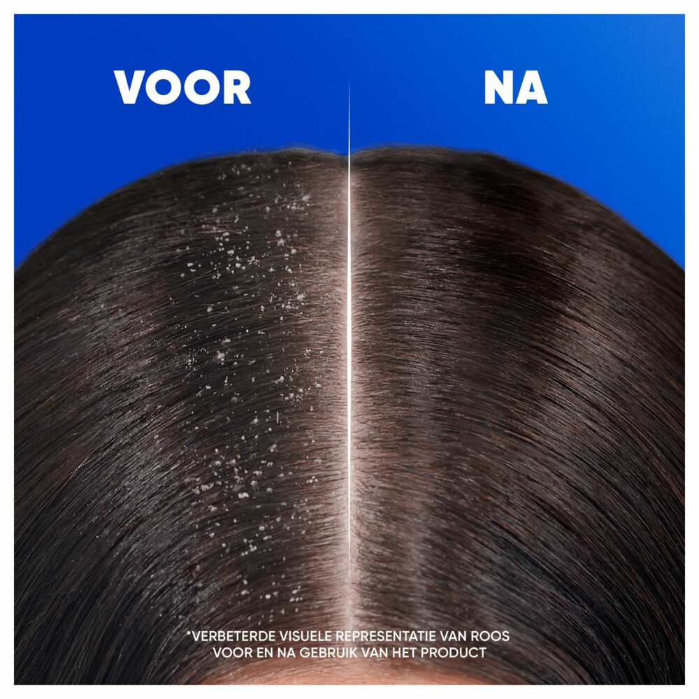 6x Head & Shoulders 2in1 Sensitive300 ml