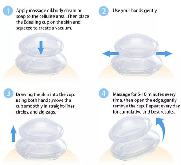 3-Pak - Kopping Sett - Koppemassasje Kopper – Cupping
