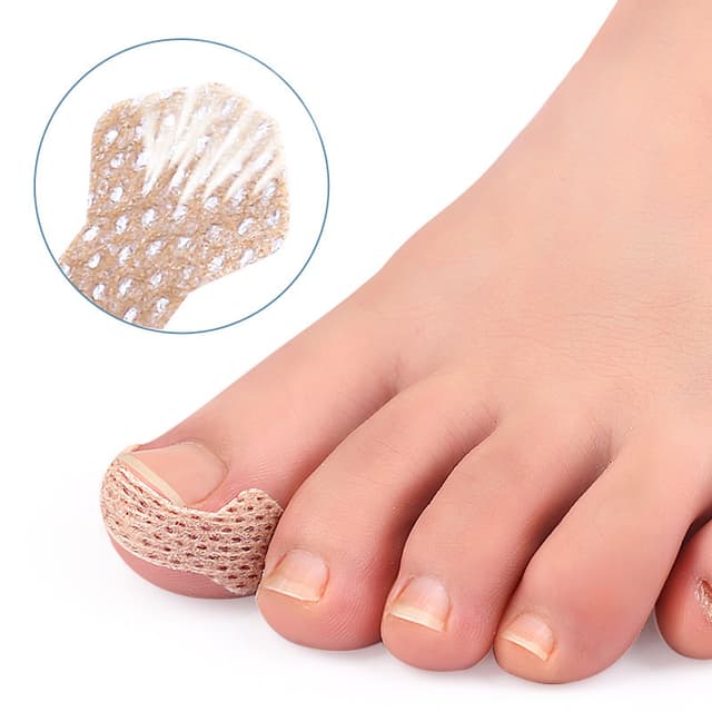 Plaster til indgroede tånegle Beige