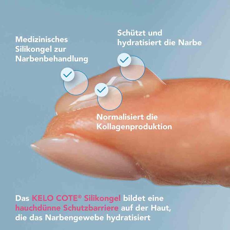 KELO-COTE® Narbengel, 6 g