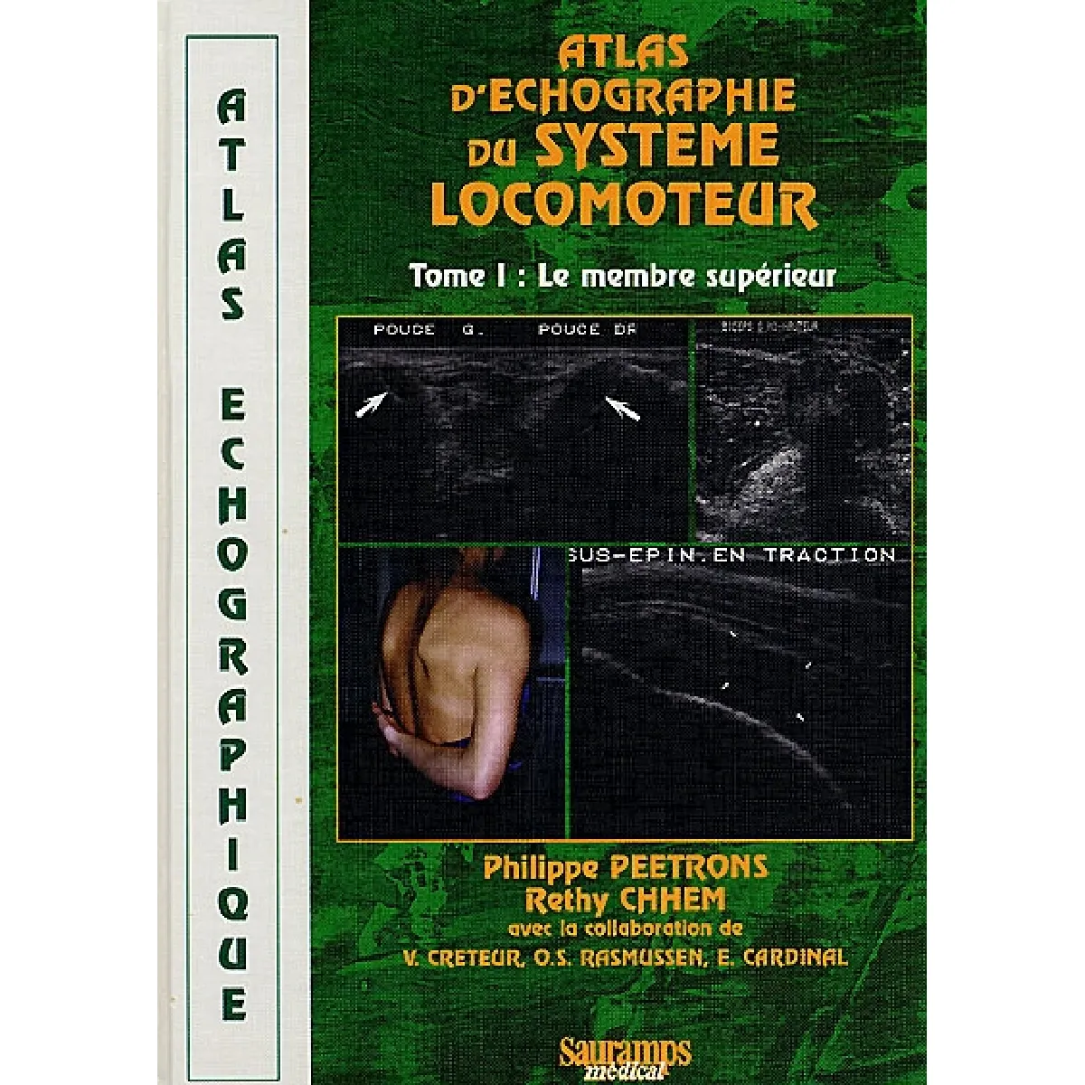 Atlas d'échographie du système locomoteur. Vol. 1. Membre supérieur · Occasion