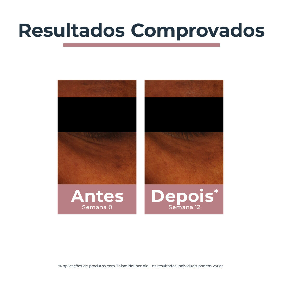 EUCERIN  Anti-Pigment Contorno de Olhos Iluminador Antiolheiras - 15ml