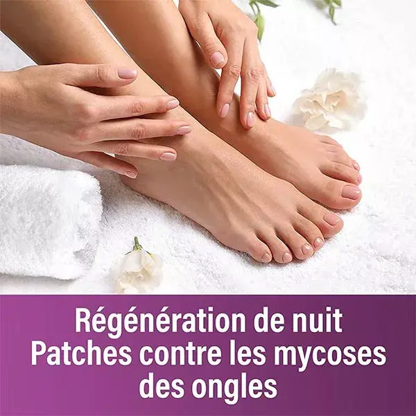 Emtrix® Night Patch - Tratamento para Micose de Unhas - 14 adesivos