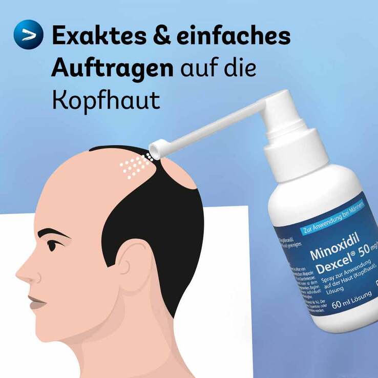 Minoxidil Dexcel 50 mg / ml Spray z.Anw.a.d.Kopfhaut, 60 ml