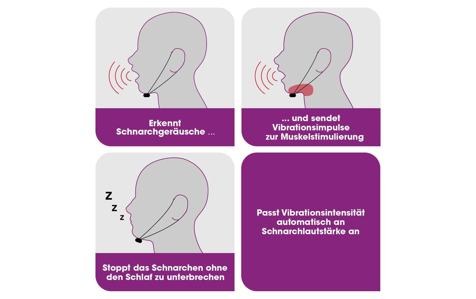 Anti-Schnarch-Gerät SchwarzSchnarchstopper